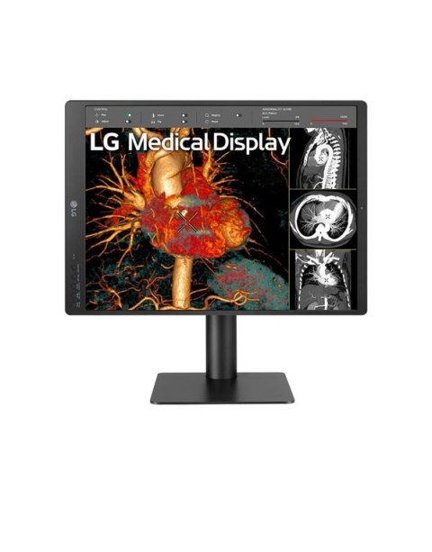 LG 21HQ513D-B/21'' Grayscale 3MP monitor komputerowy 54,1 cm (21.3") 1536 x 2048 px HD LCD Czarny LG